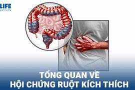 Hội Chứng Kích Thích Ruột